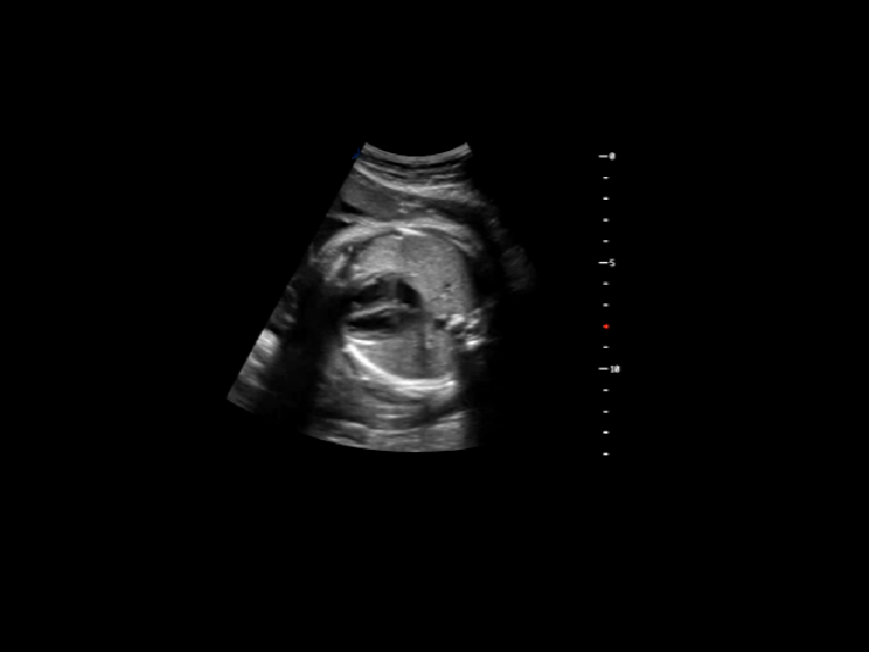 CD15 - Konica Minolta